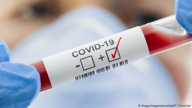 В България 6 нови случая на коронавирус на 14 март 2020