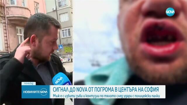 БЕЗ ВИНА: Мъж твърди, че е нападнат от полицаи в нощта на протестите в София - Новините на NOVA