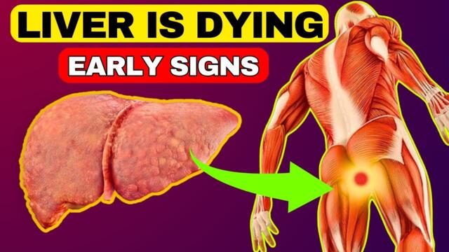 6 Weird Signs That You Have Liver Damage || HealthQuest