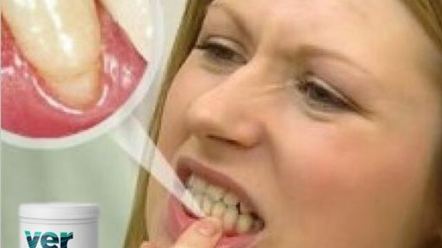 Резултат при парадонтоза