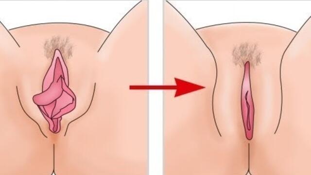 Is my vagina normal Here are the 7 different types of labia