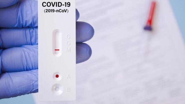 Вижте как да си направите у дома сами антигенен тест за Ковид 19