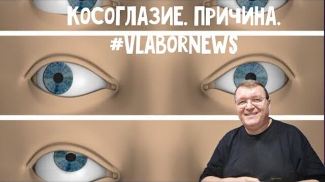 Здоровье ✓011. Косоглазие. Причина.  От смартфона #vlabornews