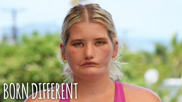 The Girl Who Can’t Smile | BORN DIFFERENT