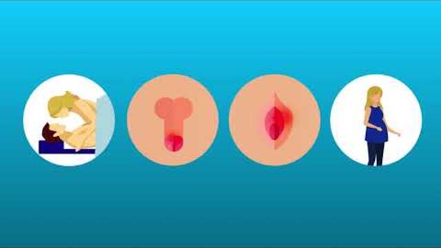 INFECCIONES DE TRANSMISION SEXUAL