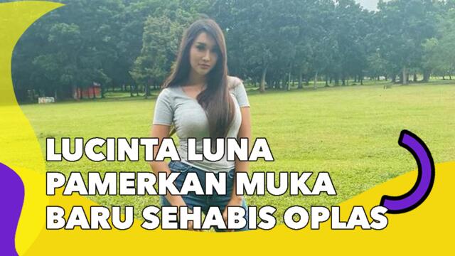 Lucinta Luna Pamerkan Muka Baru Sehabis Oplas, Boy William: Kayak Ondel-Ondel