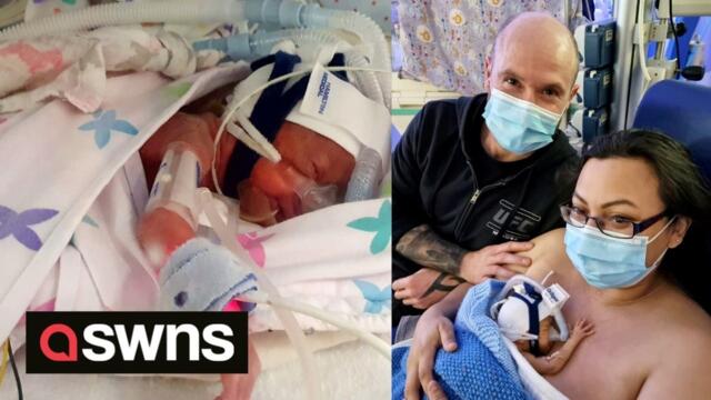 One of Britain's tiniest babies born at 1lb 4oz survived after being placed in a plastic BAG