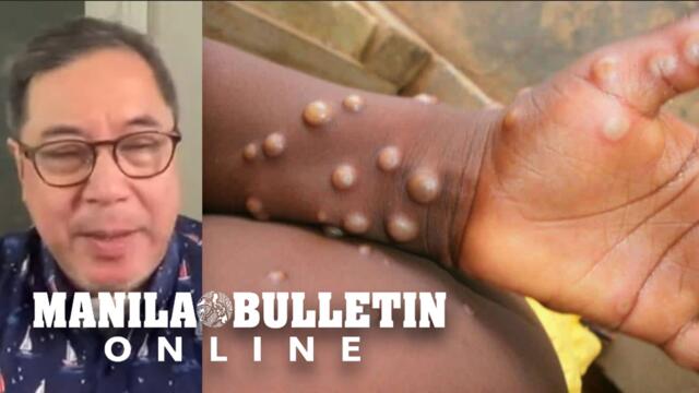 No need to close PH borders amid monkeypox threat, says Herbosa