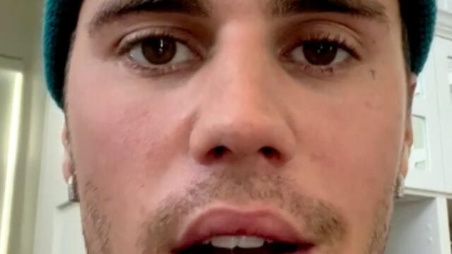 Justin Bieber suffering from facial paralysis due to Ramsay Hunt syndrome