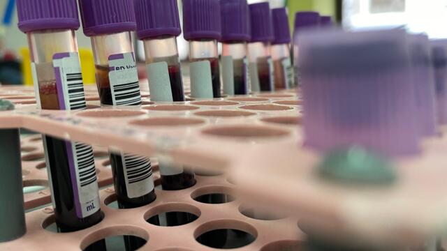 To Break the Stigma Around Monkeypox, Actor Matt Ford Shares His Story