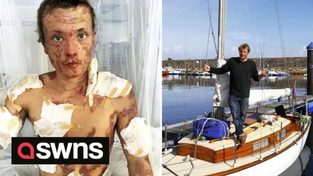 UK man who was set on fire when paraffin cooker exploded on boat has finally bravely set sail again