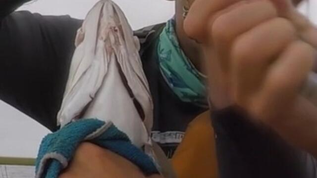 Guy Gets Fishing Hook Stuck in His Hand