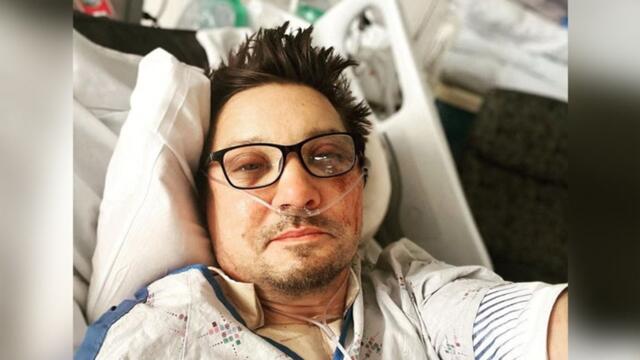 Jeremy Renner bruised and bloodied as he thanks fans in first post-accident selfie