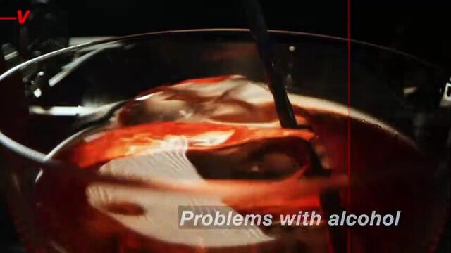 The Less Well-Known Risk of Weight-Loss Surgery