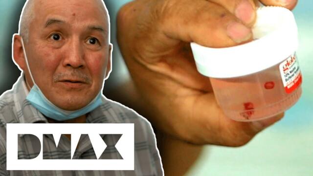 Alaskan Man Gets Alien Implant Removed From His Leg | Aliens In Alaska