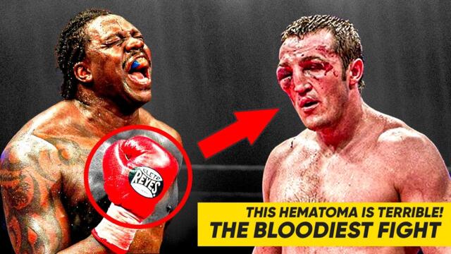 This is a Terrible HEMATOMA in the History of Boxing! This is a MUST SEE!!