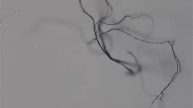 Паразити във маските / Parasites in masks