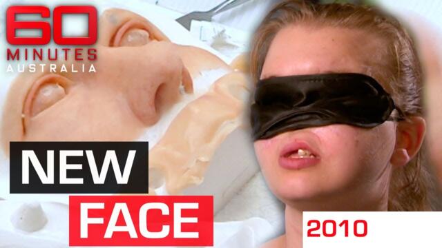 11-year wait for woman whose face was ripped off by a gun | 60 Minutes Australia