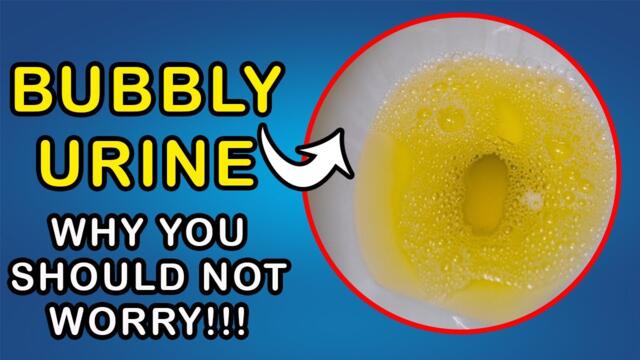 BUBBLES IN URINE: Why you don't need to worry