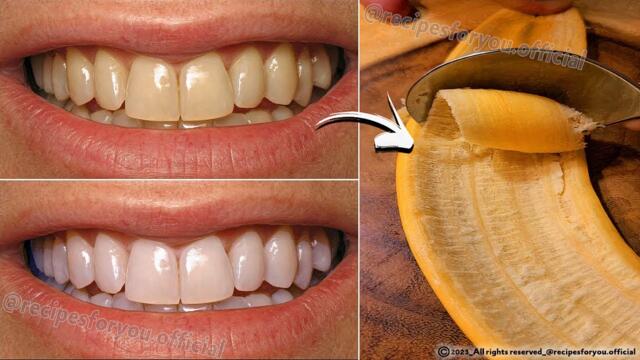 Тайна, която зъболекарите не искат да знаете: избелете зъбите само за 2 минути