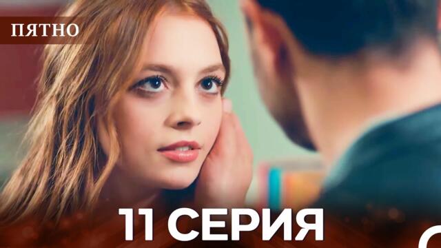 Пятно Cерия 11 (русский дубляж)