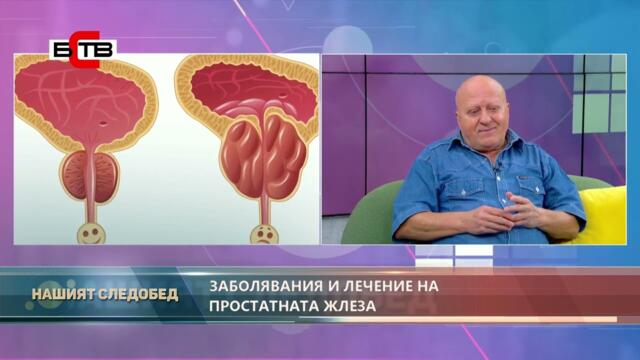 НАШИЯТ СЛЕДОБЕД с БСТВ (15.11.2022), гост: Д-Р СВЕТЛИН ДИМИТРОВ - УРОЛОГ