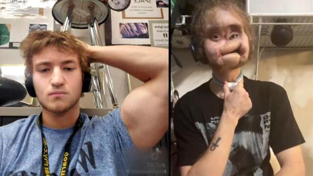 How Teen Survived Life-Changing Accident