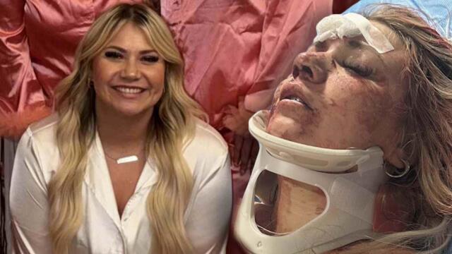 Bride-to-Be Sucker-Punched Weeks Before Wedding