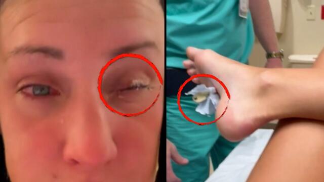 The Strangest Reasons People Went to The E.R.