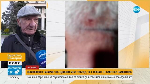 Обвинения в насилие: 80-годишен мъж твърди, че е пребит от кметски наместник