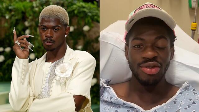 Lil Nas X Says He's Better After Being Hospitalized With Facial Paralysis