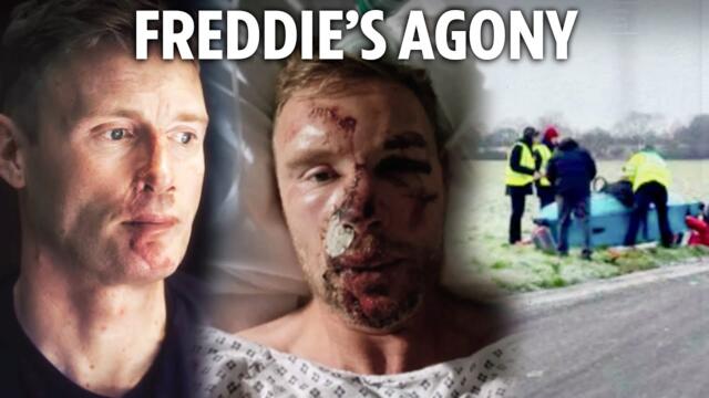 Freddie Flintoff reveals horror pics of Top Gear crash injuries for first time