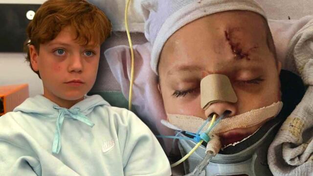 Boy Thrown off Balcony of Mall of America Making Recovery