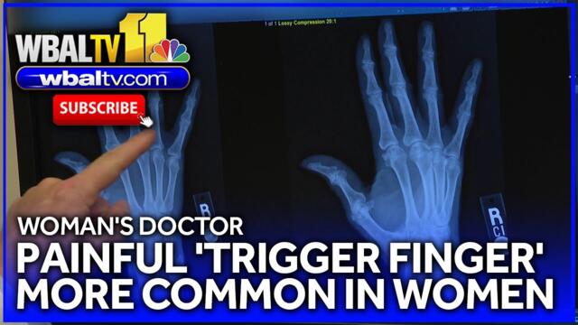 Women more frequently get painful 'trigger finger'