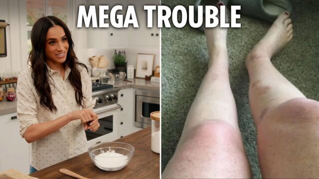 Meghan Markle fan says homemade bath salt recipe left her with ‘BURNS’ & threatens $10m lawsuit