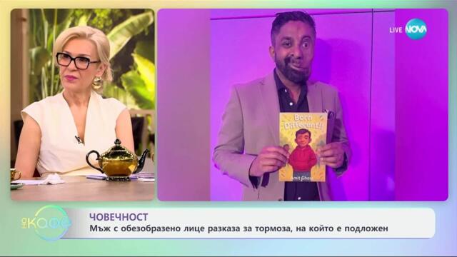 Мъж с обезобразено лице разказа за тормоза, на който е подложен - „На кафе“ (21.05.2025)