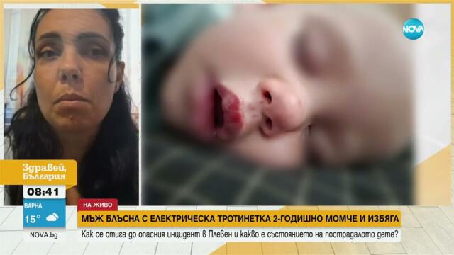 Майката на блъснатото дете в Плевен настоява за пълна забрана за тротинетките в Плевен дете