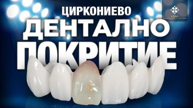 🤍 (със субтитри) Преди и след циркониеви зъбни фасети - дентална клиника Лема