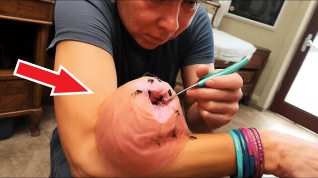 Девушка чувствует ужасную боль. Когда врач осматривает ее руку, он звонит в полицию!