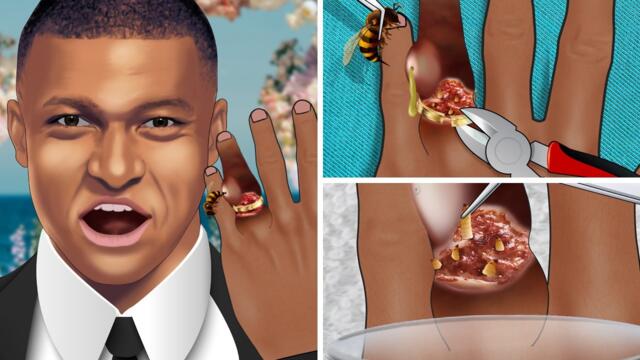 [ASMR Animation] Help Mbappé Remove the tight wedding ring | ring removal, hand cleaning