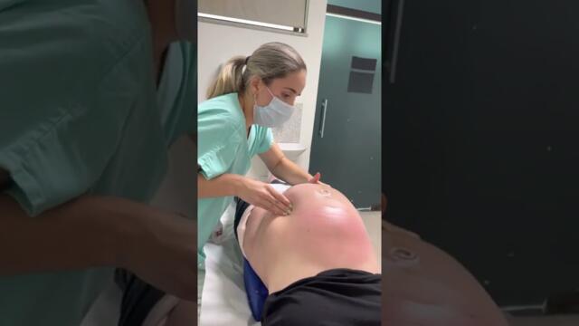 Versão cefálica externa. Procedimento para que bebês que estejam não cefálicos sejam reposicionados