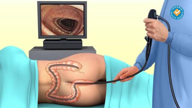 Всеки пети човек над 30 г. страда от хемороиди