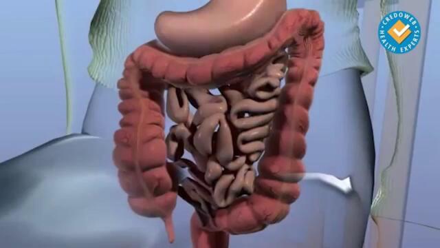 Свръхобразуване на газове и подуване на корема