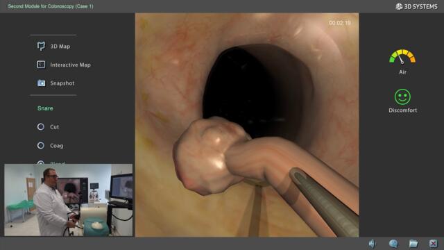 д-р Никола Боянов, тънкостите на ендоскопската полипектомия на дебело черво