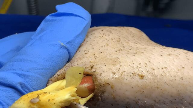 New S1 TLC DR LEE’S ULTIMATE ZITPOPPER  with Tweezer とんでもなく嬉しいことが起きたので報告します 1796