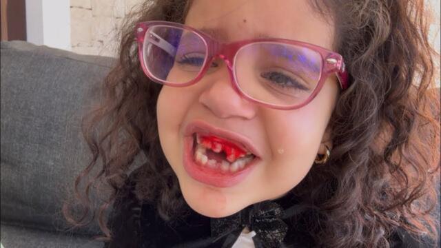 Je n’arrive pas à enlever ma dent  😭