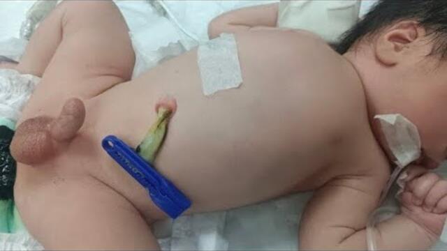 new born baby Hydration & Care 😱 #cute #baby #neonatologist