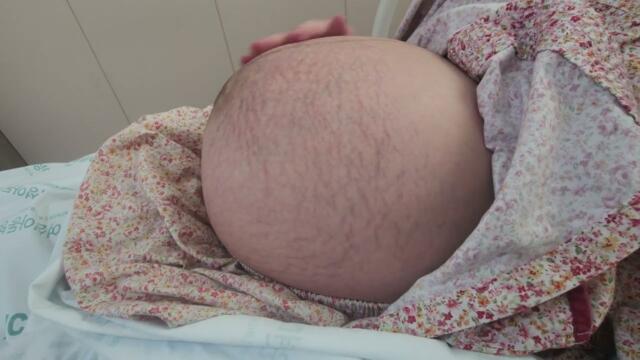 단아윤아 출산직전 산모 마지막 면회