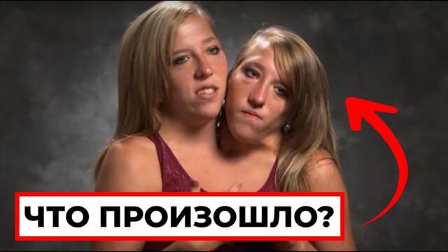 Вы Слышали Что Случилось С Сиамскими Близнецами Эбби И Бриттани?