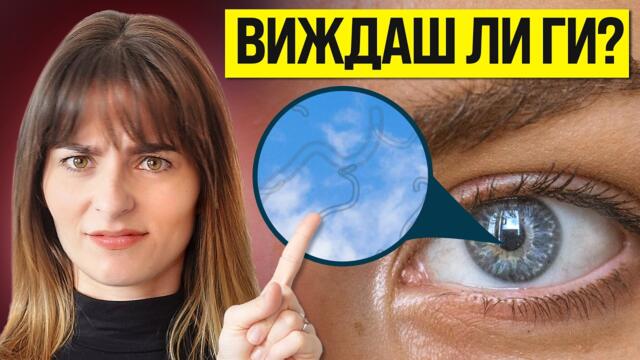 “Мушици” в Очите: Опасни Ли Са?